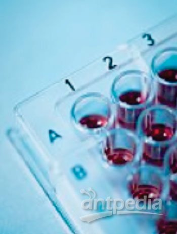 Quantose IR检验是实验室开发的检验(LDT)，它测量四种代谢产物的密度：α-羟丁酸(AHB)、亚油酸甘油磷酰胆碱(L-GPC)、油酸和胰岛素（