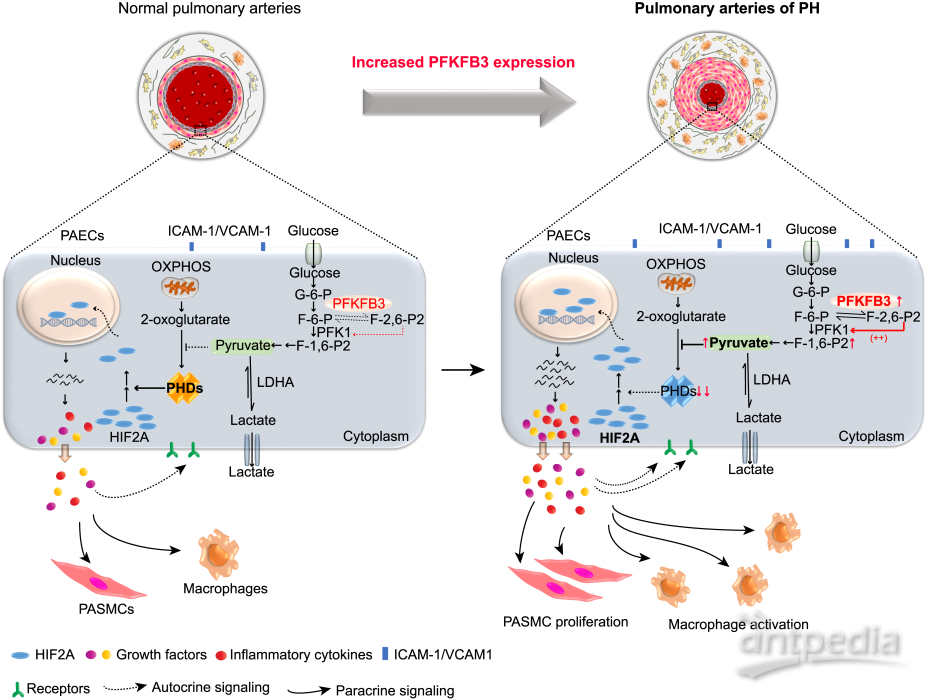 内皮细胞中PFKFB3介导的糖酵解对肺动脉高压发展的影响模式图.png