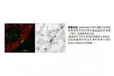 API DeltaVision OMX超高分辨率显微镜