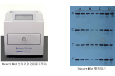 Western blot 蛋白质印迹/免疫印迹