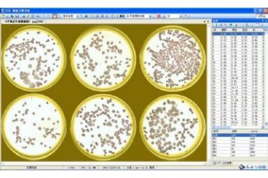 菌落计数抑菌圈测量β内酰胺酶检验细胞分析