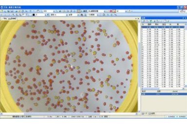 菌落计数抑菌圈测量抗生素药敏效价分析仪