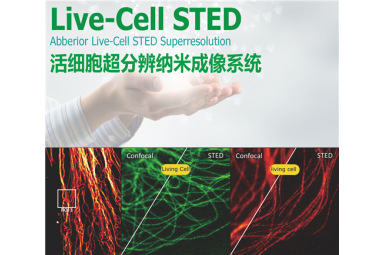 Live-Cell STED 活细胞超分辨成像系统