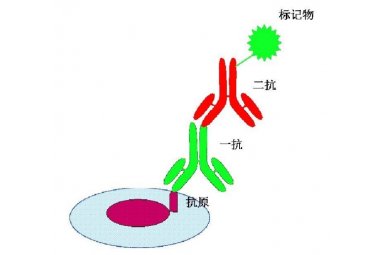 免疫组织化学（IHC）