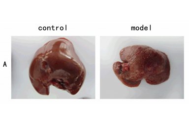 肝纤维化模型