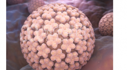 阅微基因 遗传性乳腺癌卵巢癌基因检测